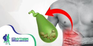 تجربتي مع استئصال المرارة