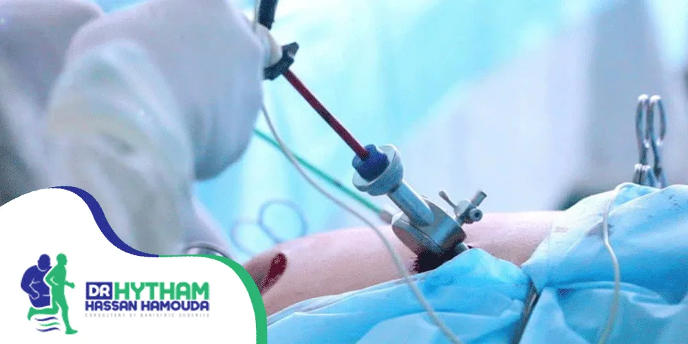 تكلفة عملية الفتق الاربي بالمنظار