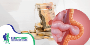 تكلفة عملية الفتق السري