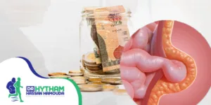 تكلفة عملية الفتق السري