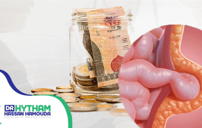 تكلفة-عملية-الفتق-السري