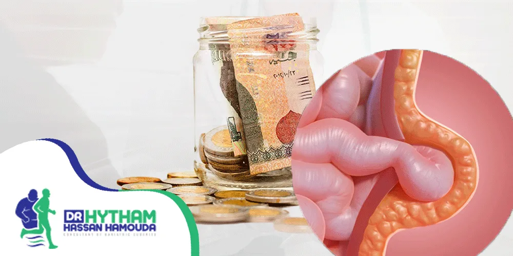 تكلفة عملية الفتق السري