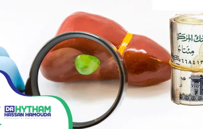 تكلفة-عملية-المرارة-بالمنظار