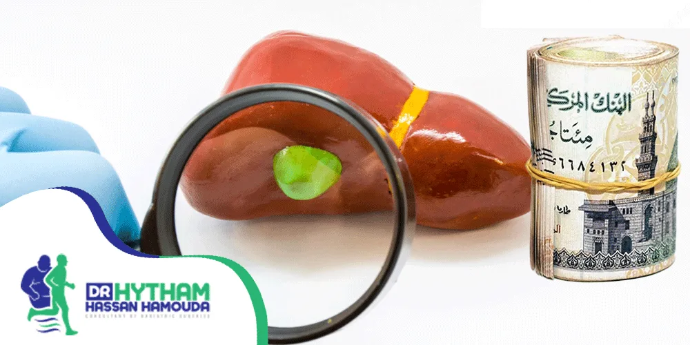 تكلفة-عملية-المرارة-بالمنظار