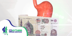 تكلفة عملية تحويل مسار المعدة المصغر