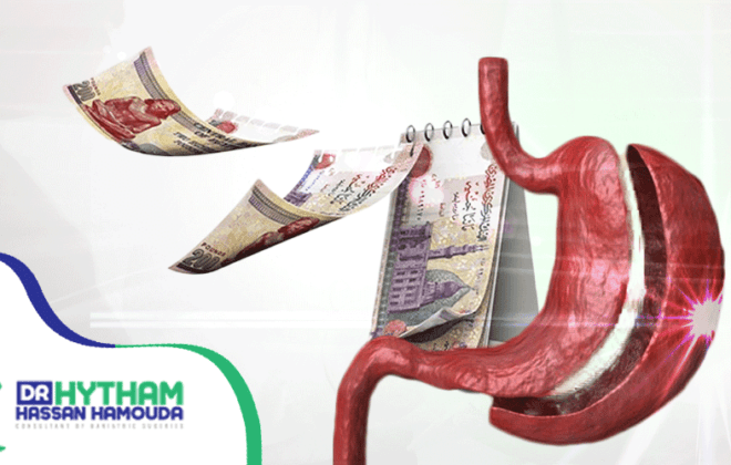سعر عملية تكميم المعدة
