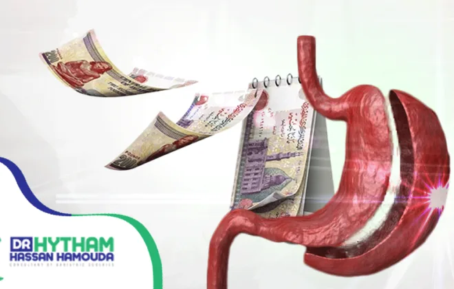 سعر عملية تكميم المعدة