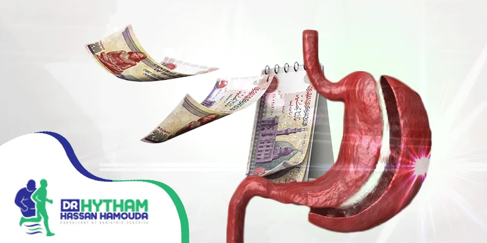 سعر عملية تكميم المعدة