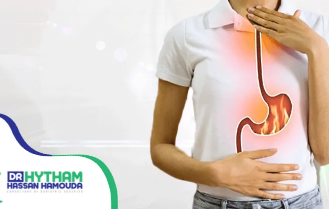 علاج-الارتجاع-المريئي علاج الارتجاع المريئي