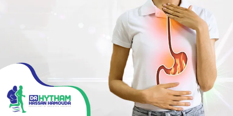 علاج-الارتجاع-المريئي علاج الارتجاع المريئي