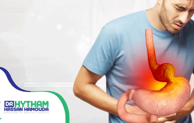 علاج-فتق-الحجاب-الحاجز