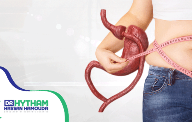 عملية-تحويل-مسار-المعدة