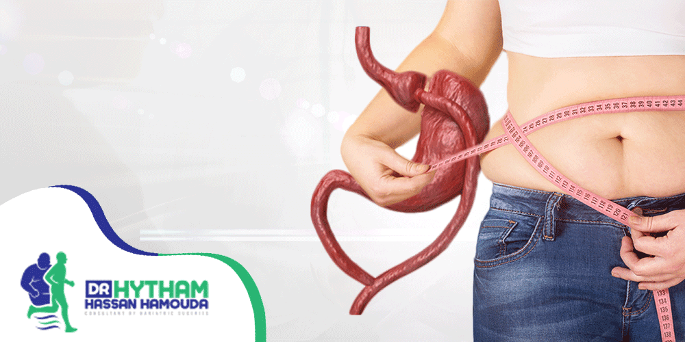 عملية-تحويل-مسار-المعدة