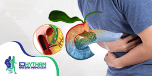 عملية-‏استئصال-المرارة