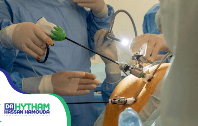 نسبة-نجاح-عملية-الفتق-السري