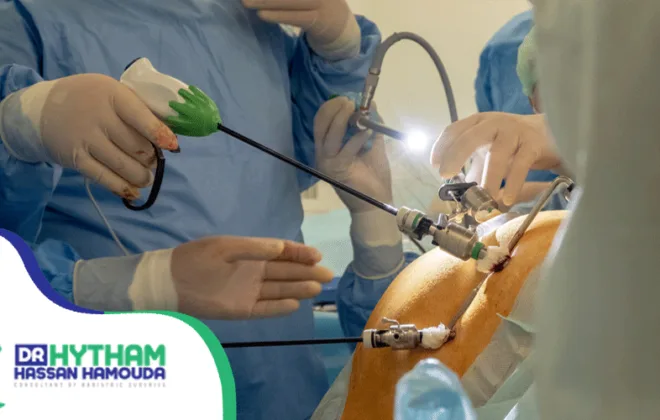 نسبة-نجاح-عملية-الفتق-السري