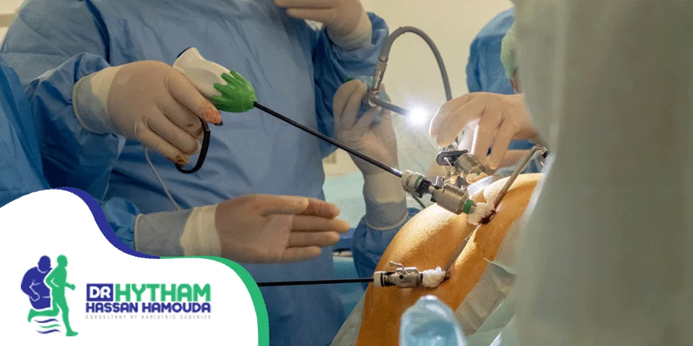 نسبة-نجاح-عملية-الفتق-السري