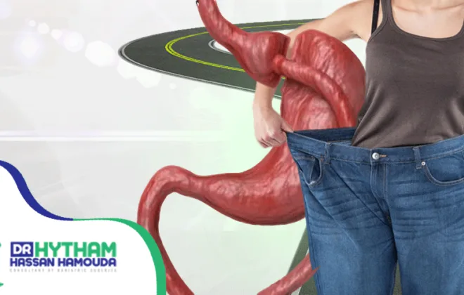 تحويل-المسار