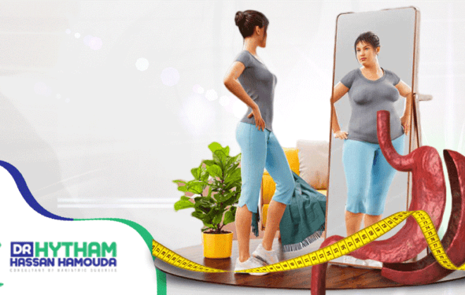 عملية تكميم المعدة بالمنظار