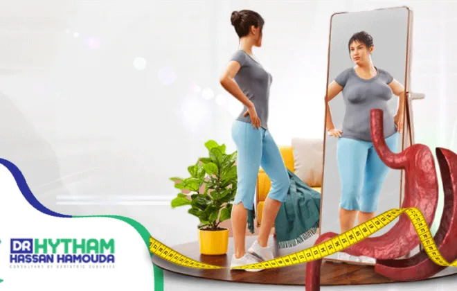 عملية تكميم المعدة بالمنظار