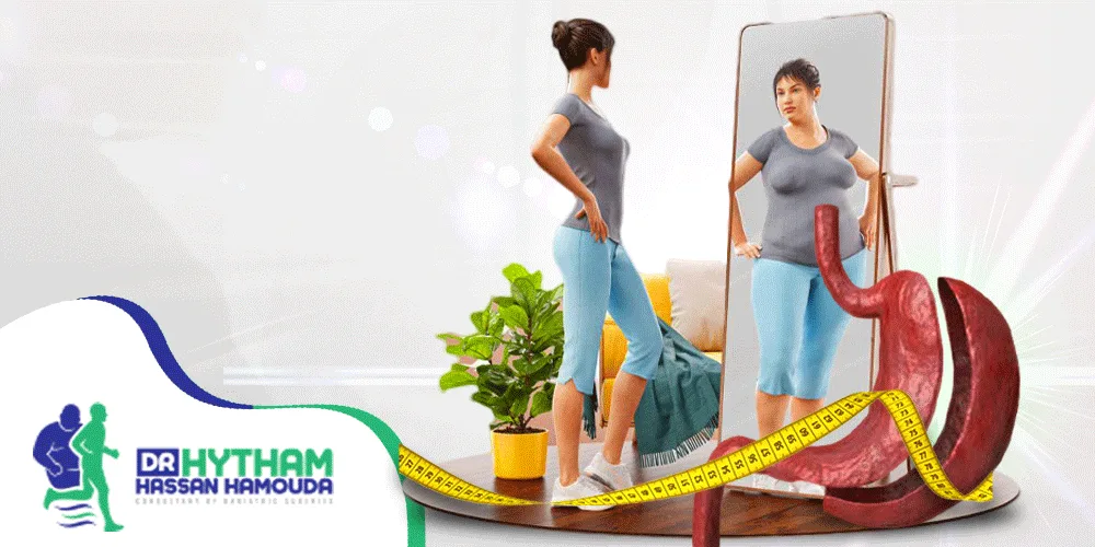عملية تكميم المعدة بالمنظار