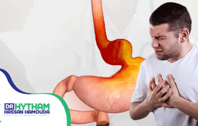 تجربتي مع فتق الحجاب الحاجز