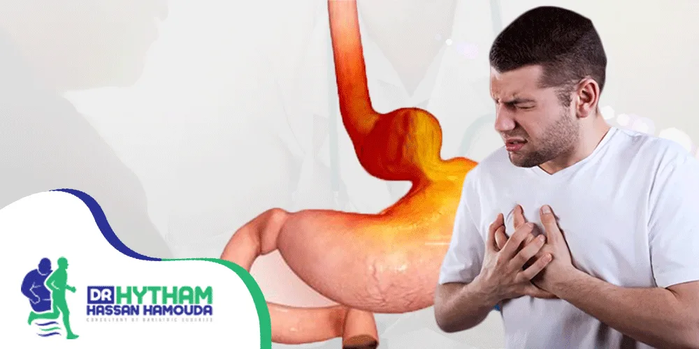 تجربتي مع فتق الحجاب الحاجز