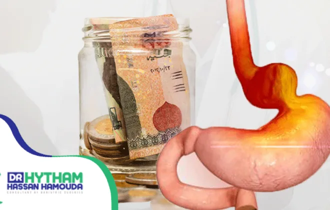 تكلفة-عملية-فتق-الحجاب-الحاجز-في-مصر