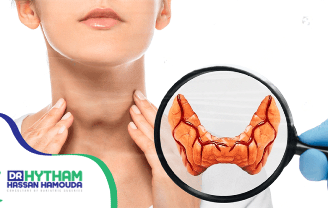 علاج-تضخم-الغدة-الدرقية-بدون-جراحة