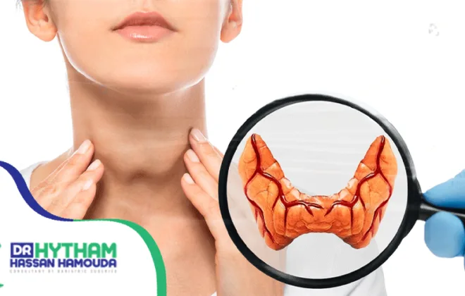 علاج-تضخم-الغدة-الدرقية-بدون-جراحة