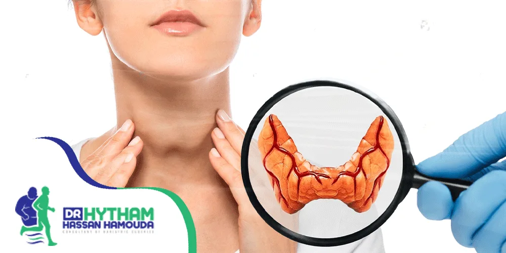علاج-تضخم-الغدة-الدرقية-بدون-جراحة