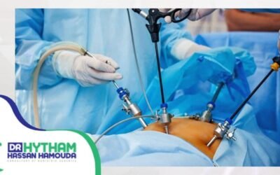 مضاعفات تحويل مسار المعدة: ما المتوقع وكيفية التعامل معها؟