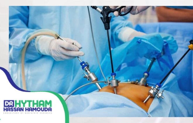 عملية التكميم بالتخدير الموضعي-اضرار عملية تكميم المعدة