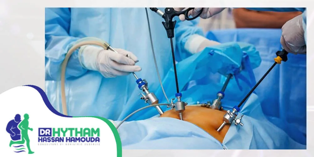 عملية التكميم بالتخدير الموضعي-اضرار عملية تكميم المعدة