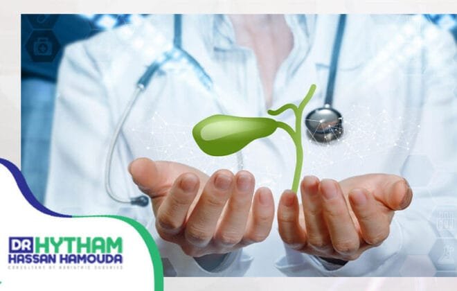 فترة التعافي بعد استئصال المرارة بالمنظار