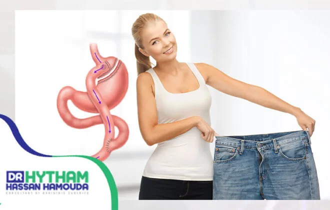 مابعد عمليه تحويل المسار