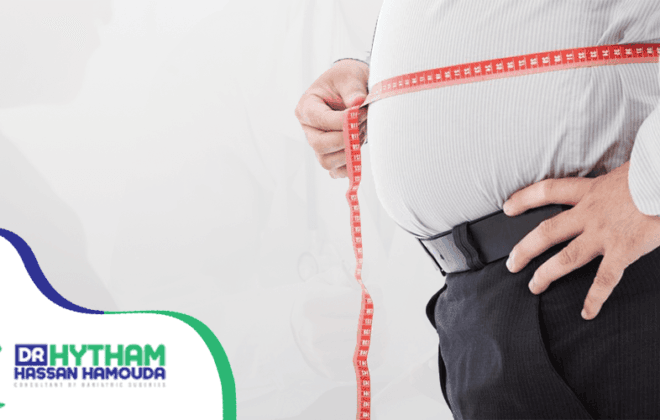 تفاوت الاسعار في عمليات السمنة