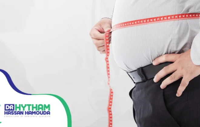 تفاوت الاسعار في عمليات السمنة