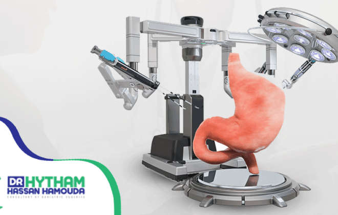 عملية التكميم البكيني