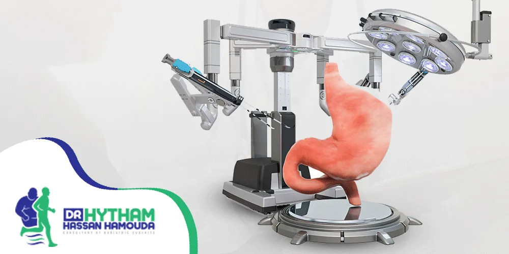 عملية التكميم البكيني