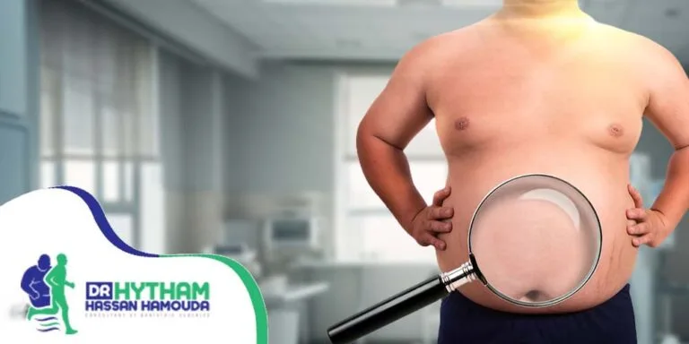 التئام المعدة بعد عملية التكميم-عملية التكميم المعدل