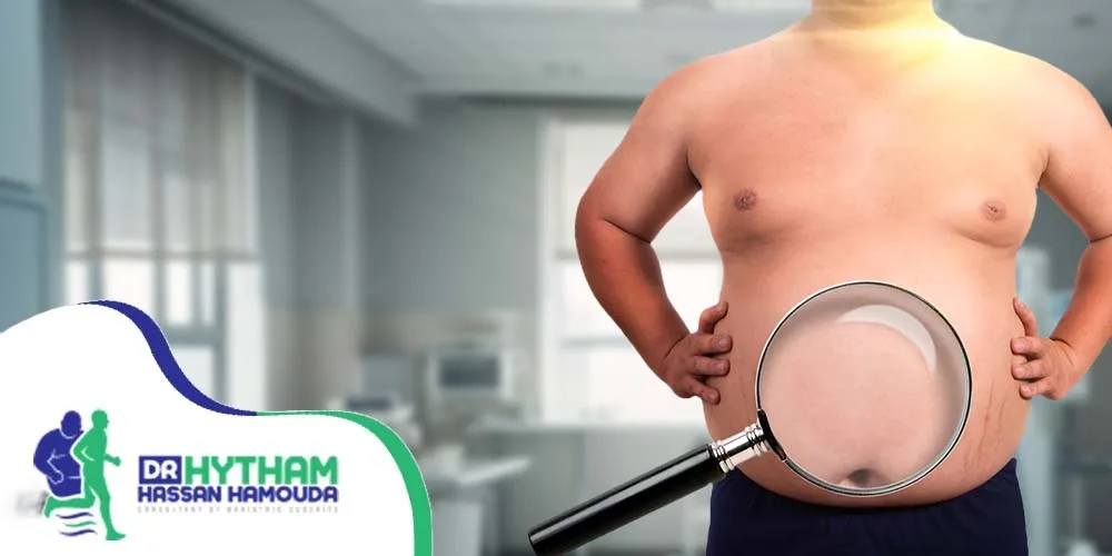 التئام المعدة بعد عملية التكميم-عملية التكميم المعدل