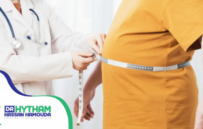 فوائد تكميم المعدة