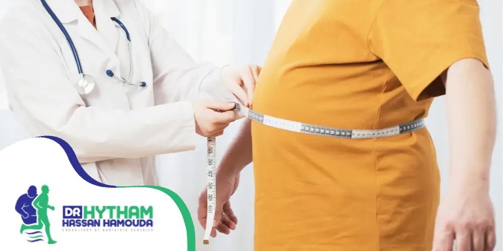 فوائد تكميم المعدة