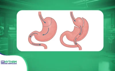 الفرق بين تحويل المسار الكلاسيكي والمصغر وما الذي يحدد الأنسب لك؟