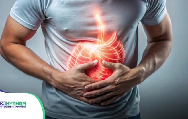 أعراض فتق الحجاب الحاجز