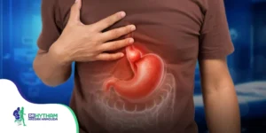 أنواع فتق الحجاب الحاجز