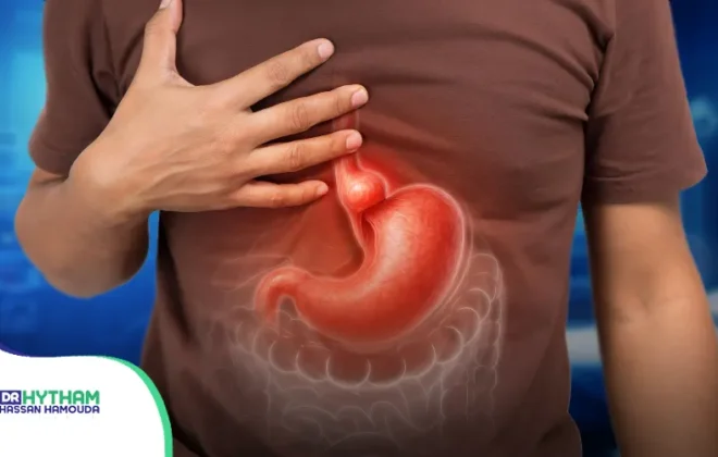 أنواع فتق الحجاب الحاجز