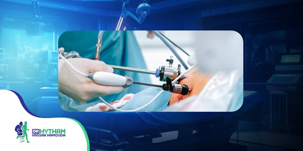 عملية الفتق الإربي بالمنظار