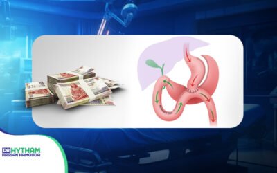 تكلفة عملية الساسي في مصر 2026: السعر وعوامله والمقارنة